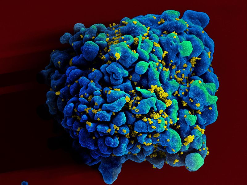 Thailand’s pharmacies can now legally sell HIV self-test kits